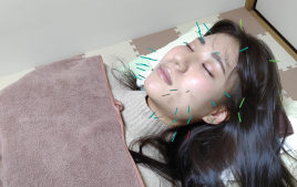 メニュー：美容鍼施術　６０分コース イメージ